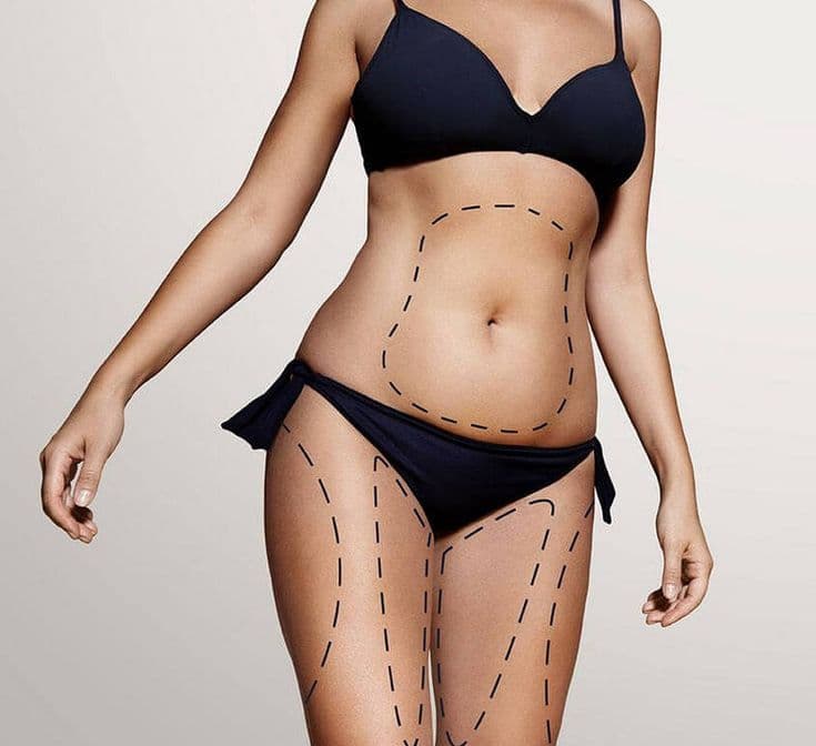 Body contouring before — surgical planning at Miami Plastic Surgery Peshawar