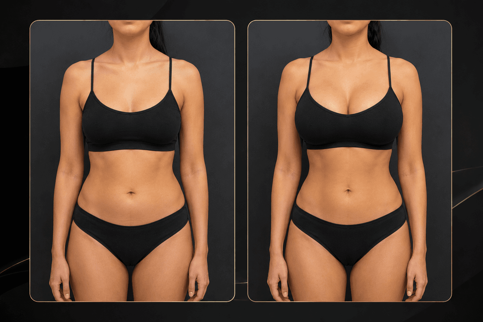 Breast surgery before — breast augmentation Peshawar