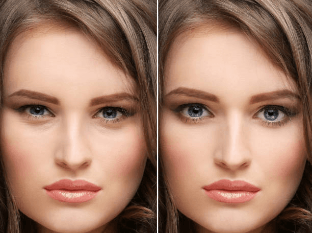 Eyebrow restoration shape comparison