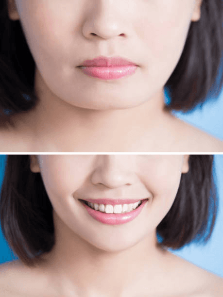 Smile and chin balance comparison reference