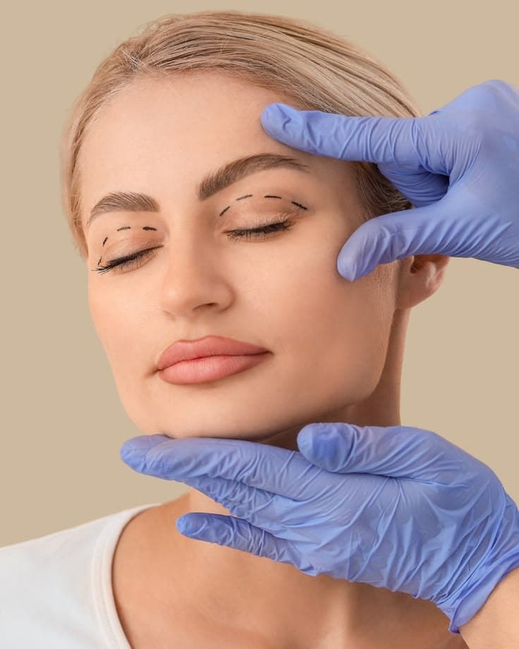 Upper and lower eyelid surgery consultation in Peshawar
