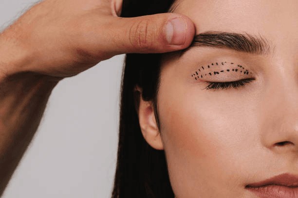 Blepharoplasty in Peshawar eye analysis