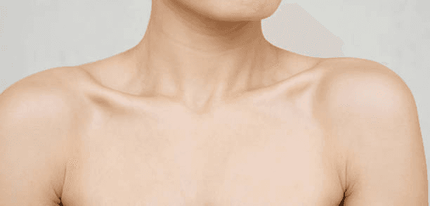 Non-surgical skin tightening neck detail
