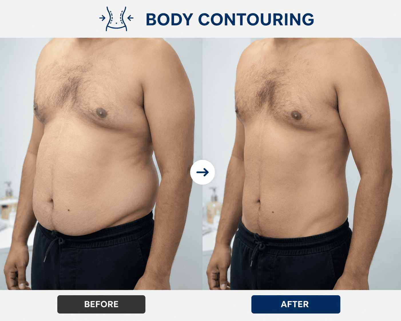 Body contouring procedures – liposuction tummy tuck Peshawar