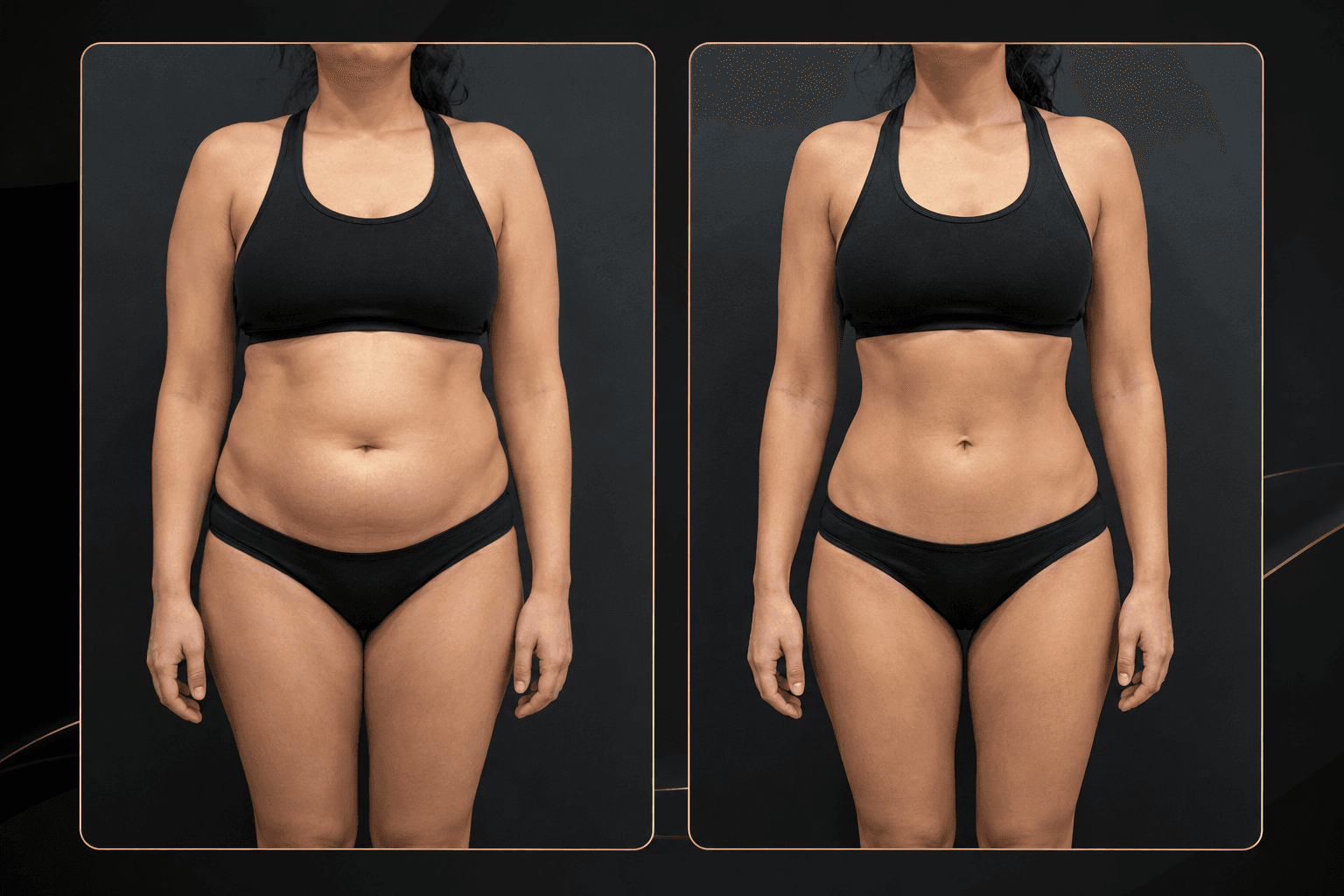 Body Transformation before