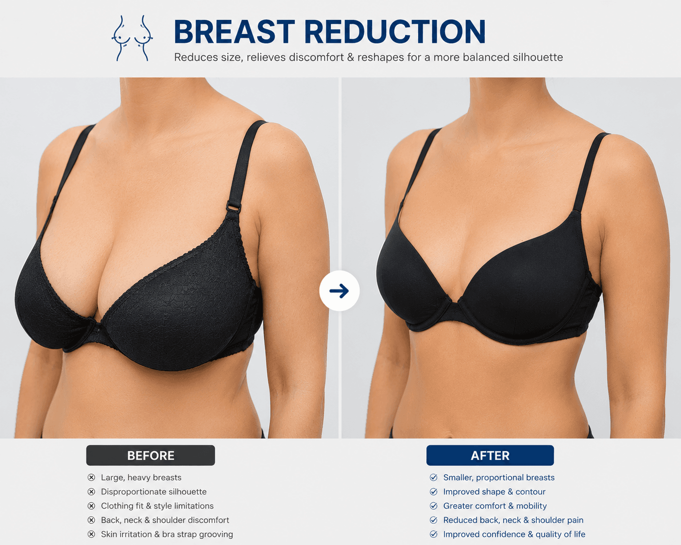 Breast Reduction – breast surgery Miami clinic Peshawar