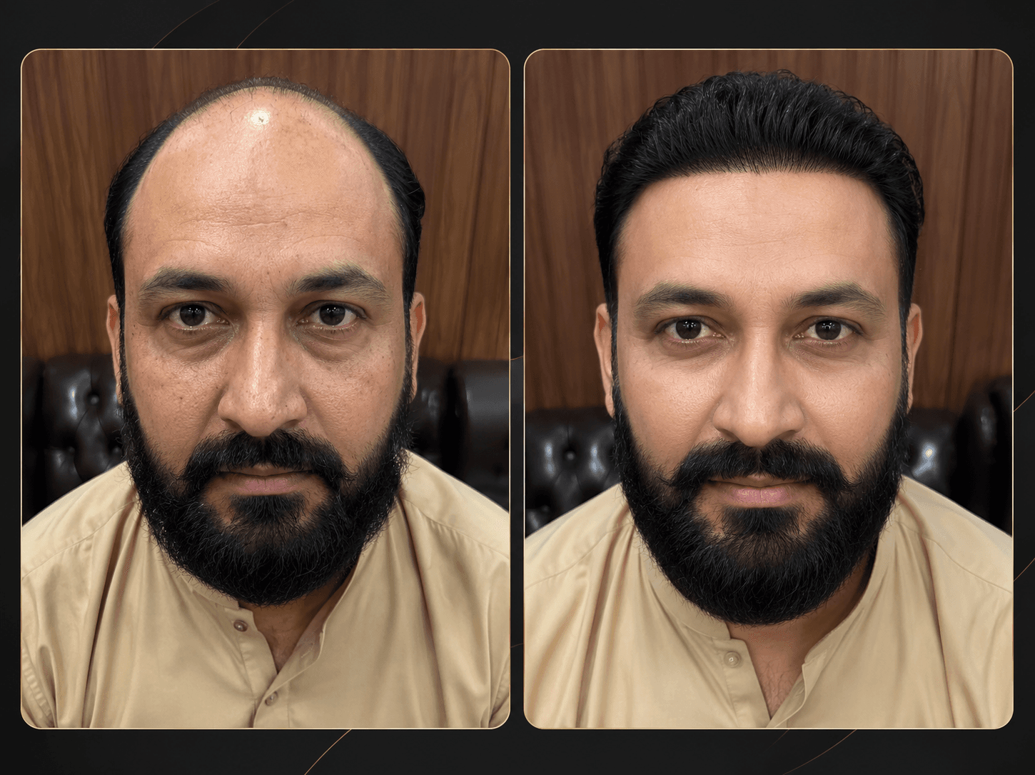 Non-Surgical Rejuvenation before